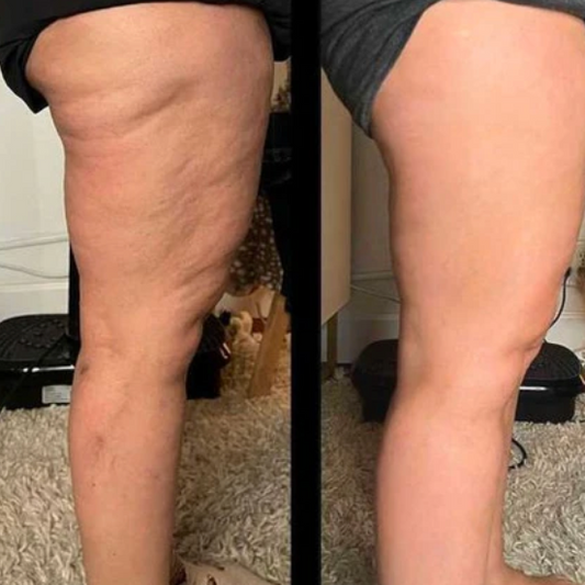 Drainage lymphatique : c'est quoi et comment ça aide contre la cellulite | Direct Québec